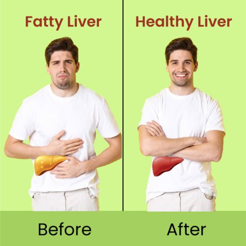 Fatty Liver Solution Capsule 60's - Image 3